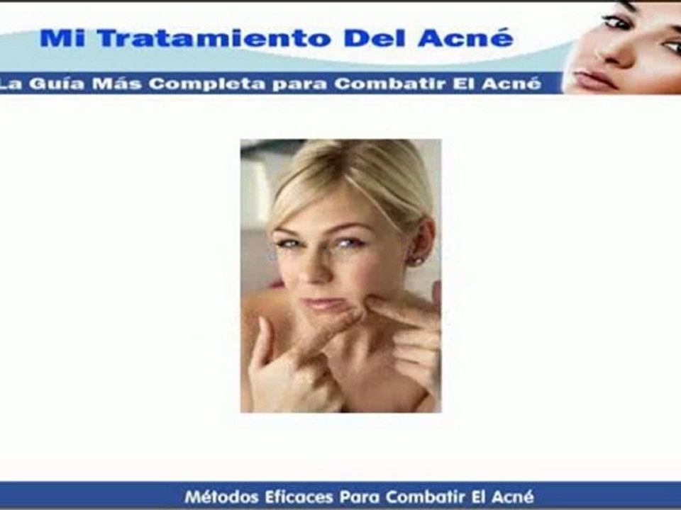 Clases de Acne