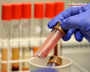 Bactérie meurtrière  en Allemagne : êtes-vous inquiets ?