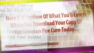 chicken pox adults - baby chicken pox - chicken pox remedies