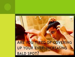 Finpecia Finasteride