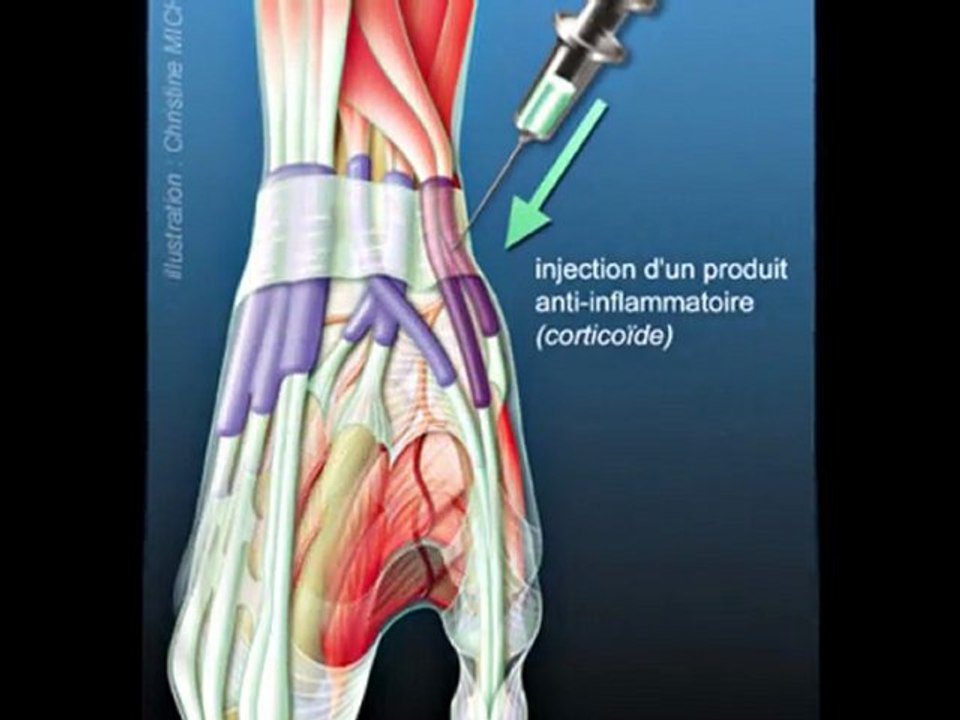 Interview de Christine Michot
