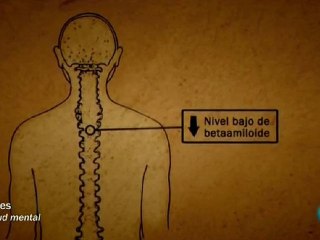 La enfermedad de Alzheimer: Terapia ocupacional