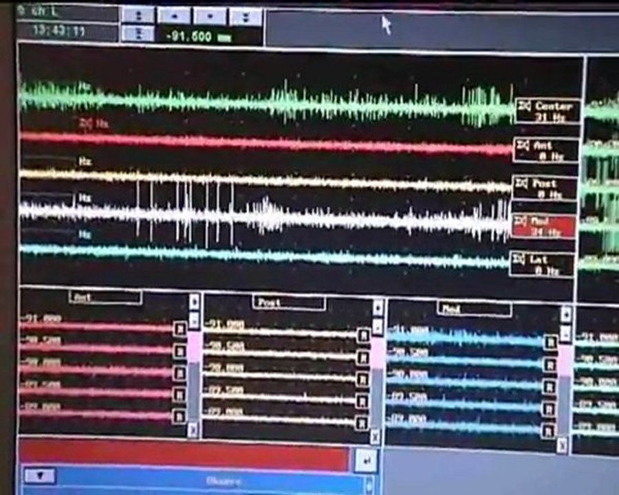 ThalSTN