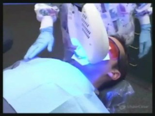 Laser Teeth Whitening by Kamran Sahabi Dentist Glendale, CA