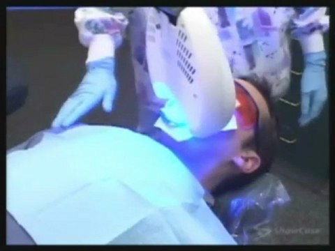 Laser Teeth Whitening by Kamran Sahabi Dentist Glendale, CA