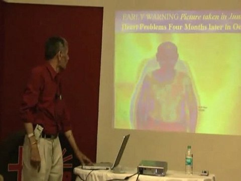 Natural Bypass Psychic Surgery, Spiritual Healing Part 3.wmv