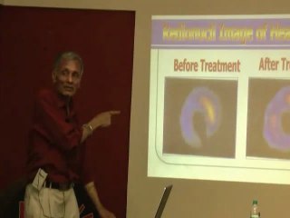 Natural Bypass -- Psychic Surgery, Spiritual Healing Part 4.wmv