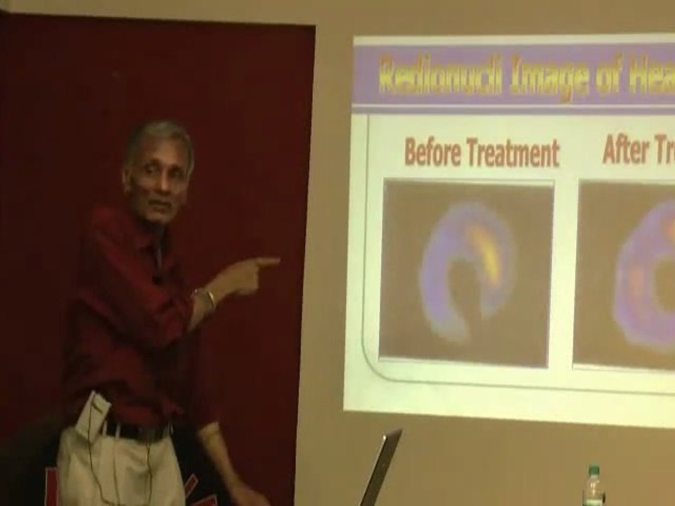 Natural Bypass -- Psychic Surgery, Spiritual Healing Part 4.wmv