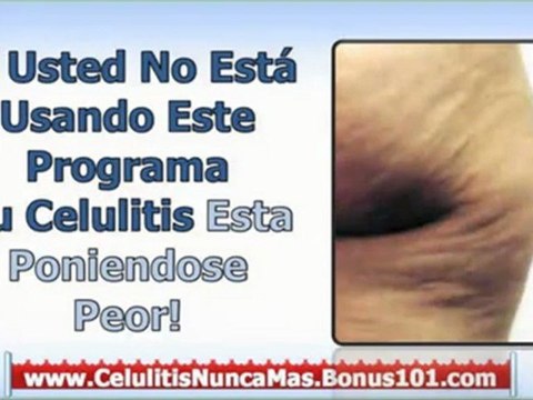 celulitis tratamiento casero - remedios para la celulitis - tratamientos celulitis