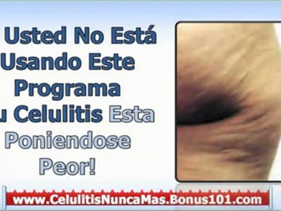 celulitis tratamiento casero - remedios para la celulitis - tratamientos celulitis
