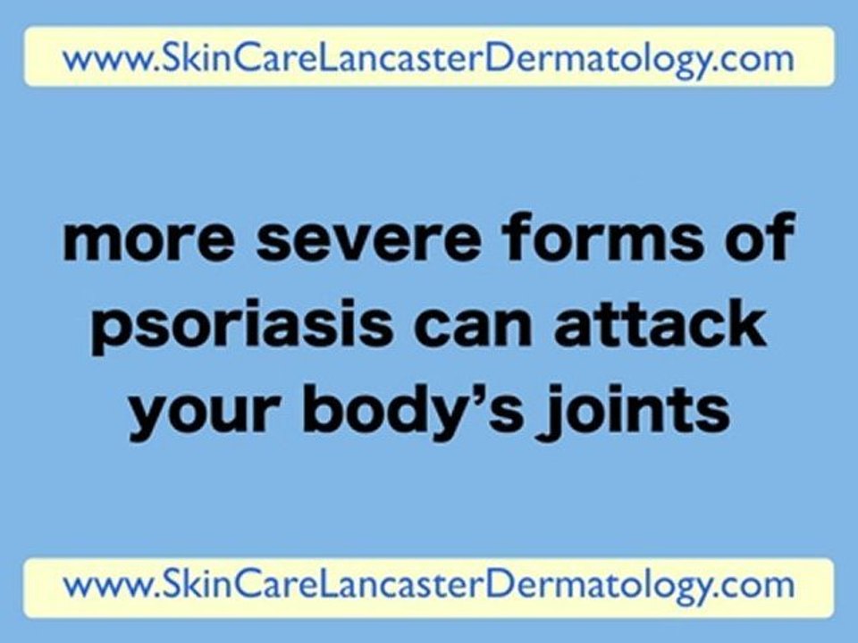 Dermatologist Lancaster PA - Dermatology Lancaster PA