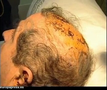 Sufre graves lesiones por ataque de perros