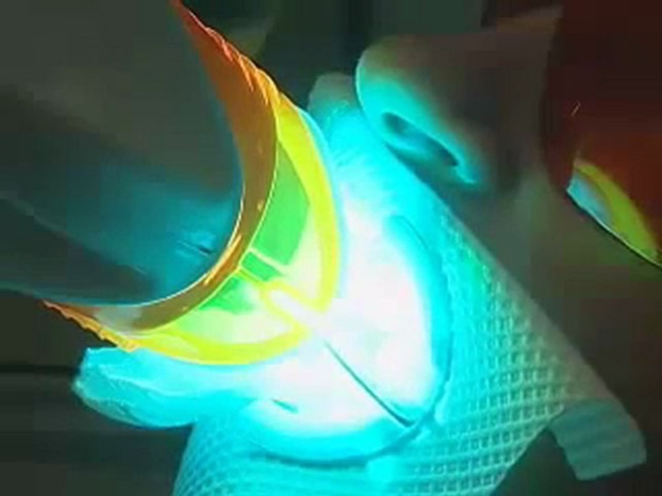 bella labs teeth whitening