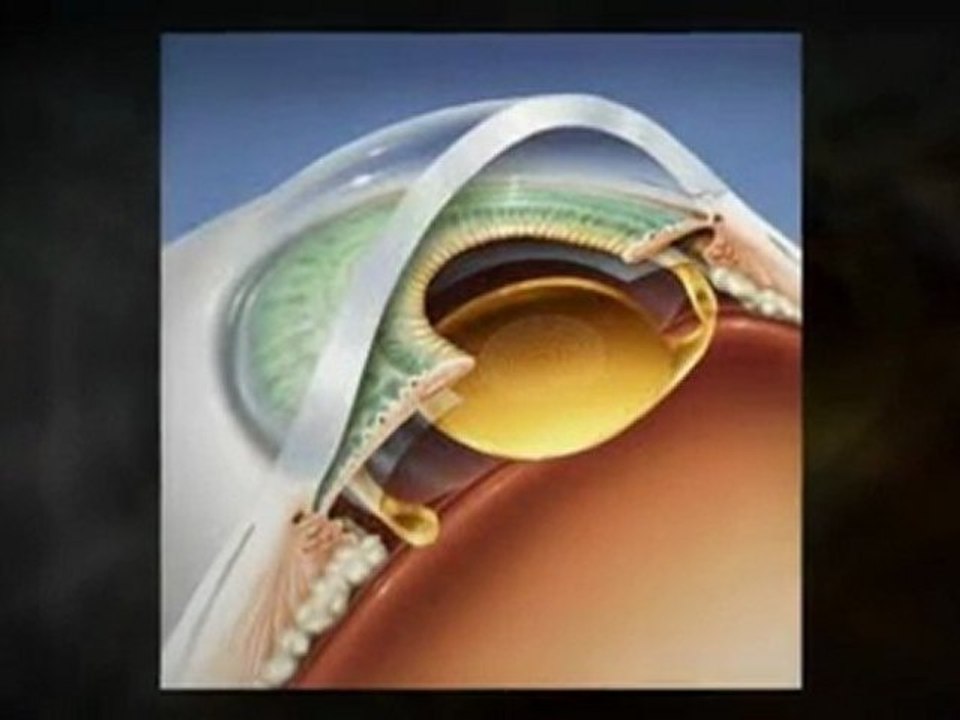 A Center for Austin Vision Correction Services