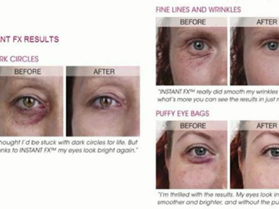 Skin Physics Instant FX - Remove Eye Wrinkles