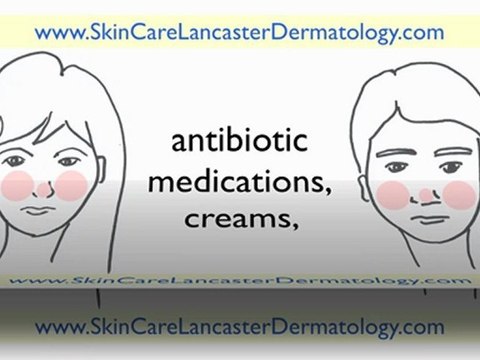 Dermatologist Lancaster PA - Dermatologist in Lancaster PA