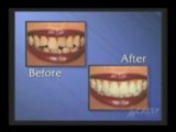 Cosmetic Dentistry by Kamran Sahabi Dentist Glendale, CA