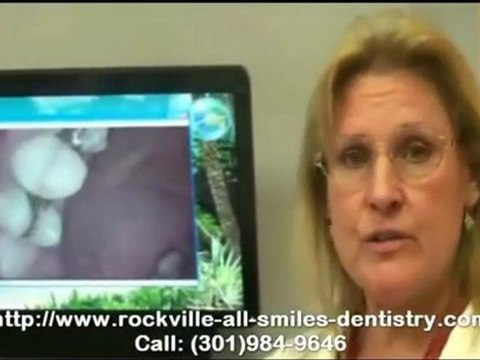 Rockville Cosmetic Dentistry - Intra-Oral Camera