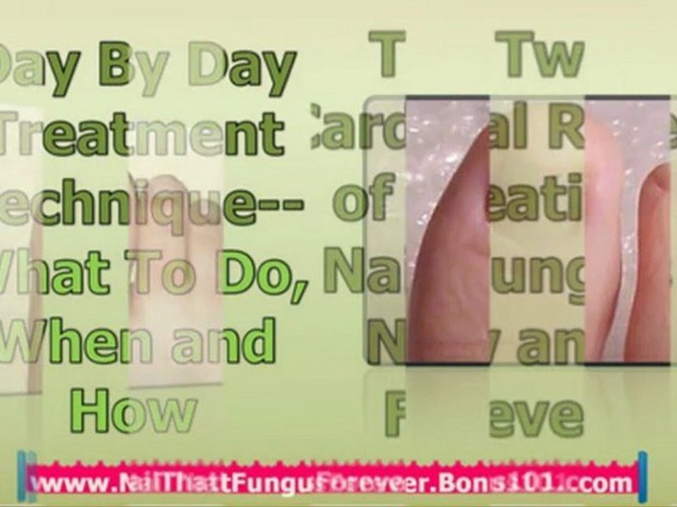 foot fungus cure - get rid of nail fungus - foot fungus treatment