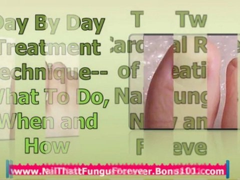 foot fungus cure - get rid of nail fungus - foot fungus treatment