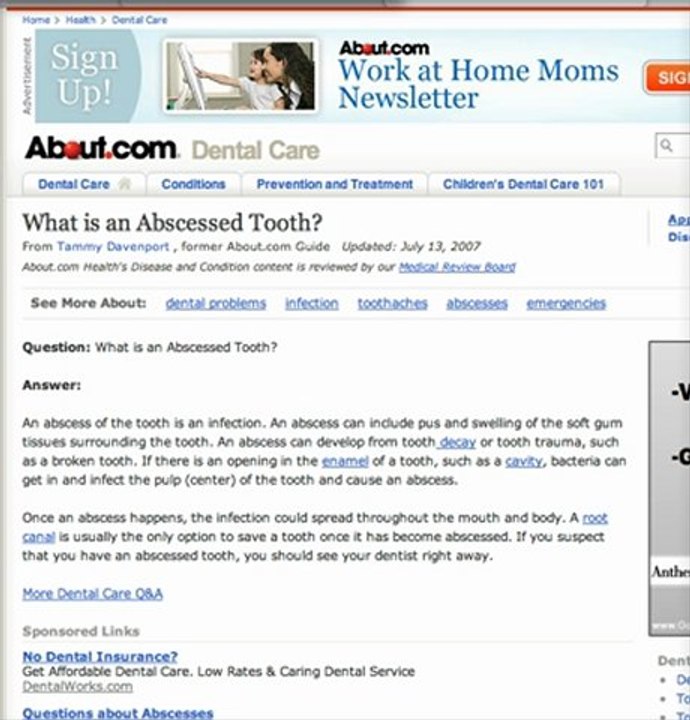 Gahanna Dentist- What is an Abscessed Tooth?