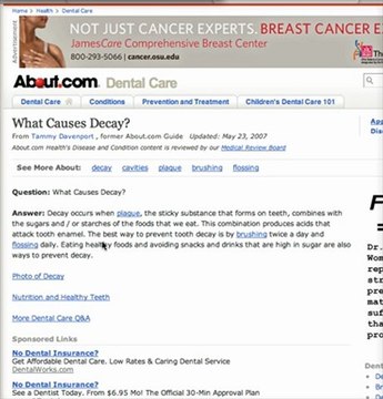 Gahanna Dentist- What Causes Tooth Decay?