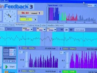 Drake Institute ADHD Treatment on CNN