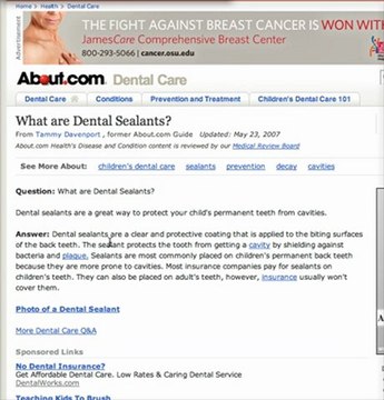 Gahanna Dentist- What are Dental Sealants?