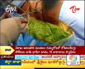 ETV2 Sukhibhava -- Back pain problem & Doctor Suggestions - 03