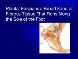 Chiropractor Rogers AR | Plantar Fasciitis | Foot Levelers