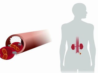 La Escherichia coli enterohemorrágica