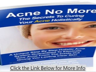 Cure Acne Holistically