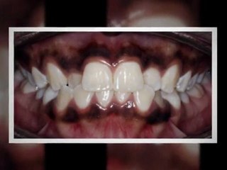 Houston Orthodontist June2011