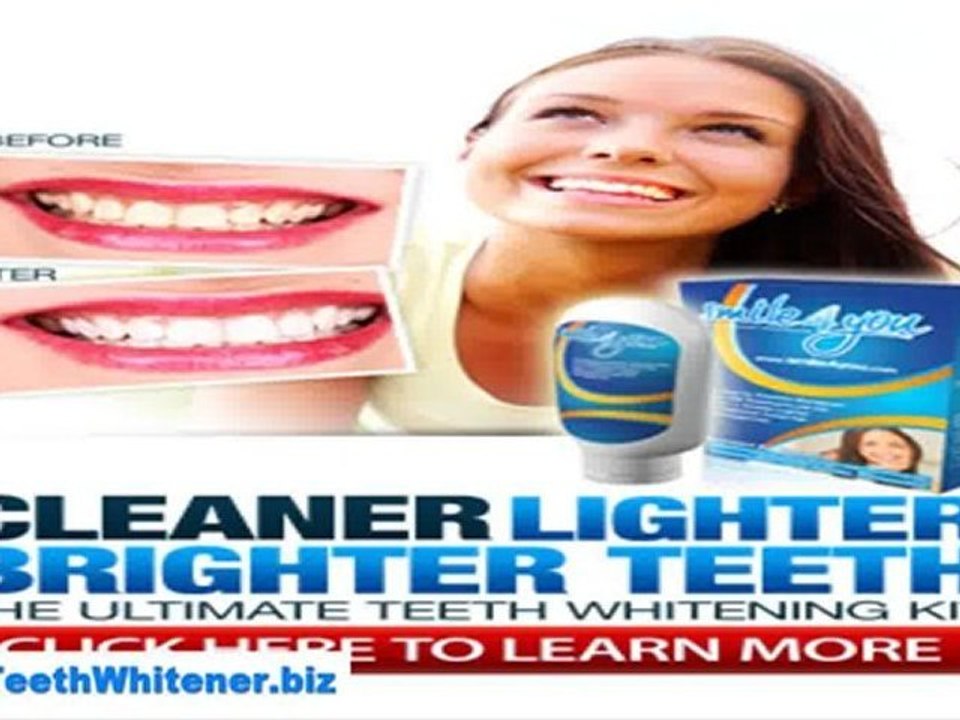 Get whiter teeth at home