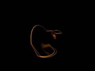 RespiFacile sous différents angles