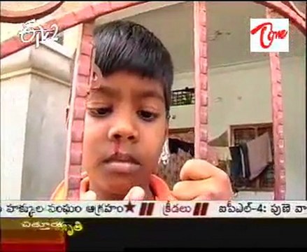 ETV2 Sukhibhava - Health Problems & Doctor Suggestions - 01