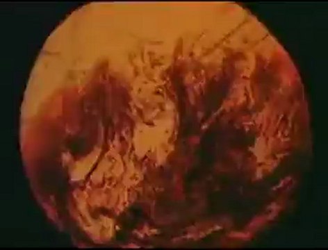 Assassin - L'écologie, Sauvons la planète / Ecology, save the planet English subtitles