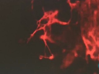 Celulas madre pluripotentes inducidas (IPS)