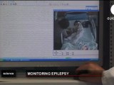 Epilepsia infantil: Videosupervision a distancia