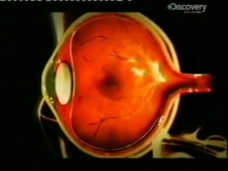 Toxoplasmosis: Parasitos en la retina (Toxoplasma gondii)