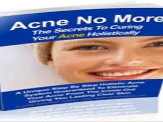 Natural Acne Cures