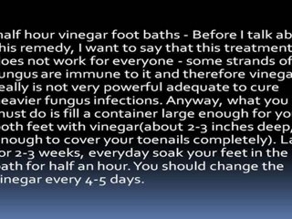 Ingrown toenail Remedies