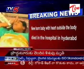 New born baby with heart outside the body died