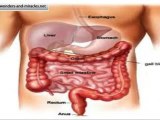 colon cancer symptoms in men