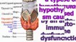 hypothyroidism natural treatment - hypothyroidism natural remedies