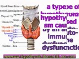 hypothyroidism cure - hypothyroidism remedy - hypothyroidism in men