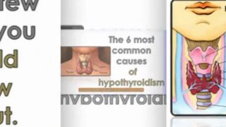 natural remedies for hypothyroidism - hypothyroidism natural treatment