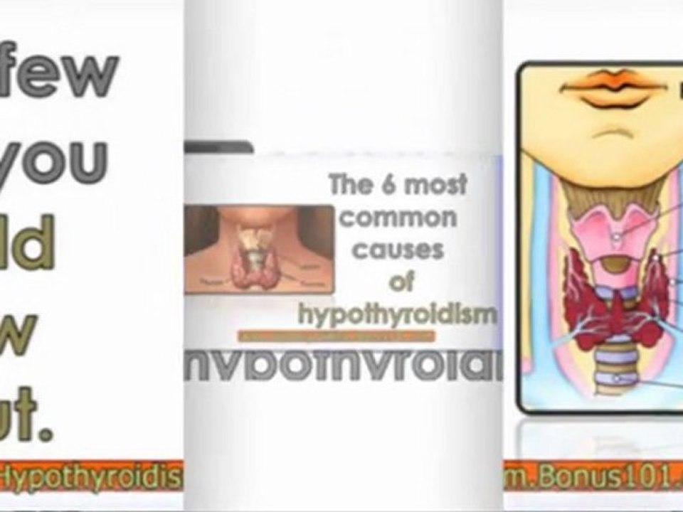 natural remedies for hypothyroidism - hypothyroidism natural treatment