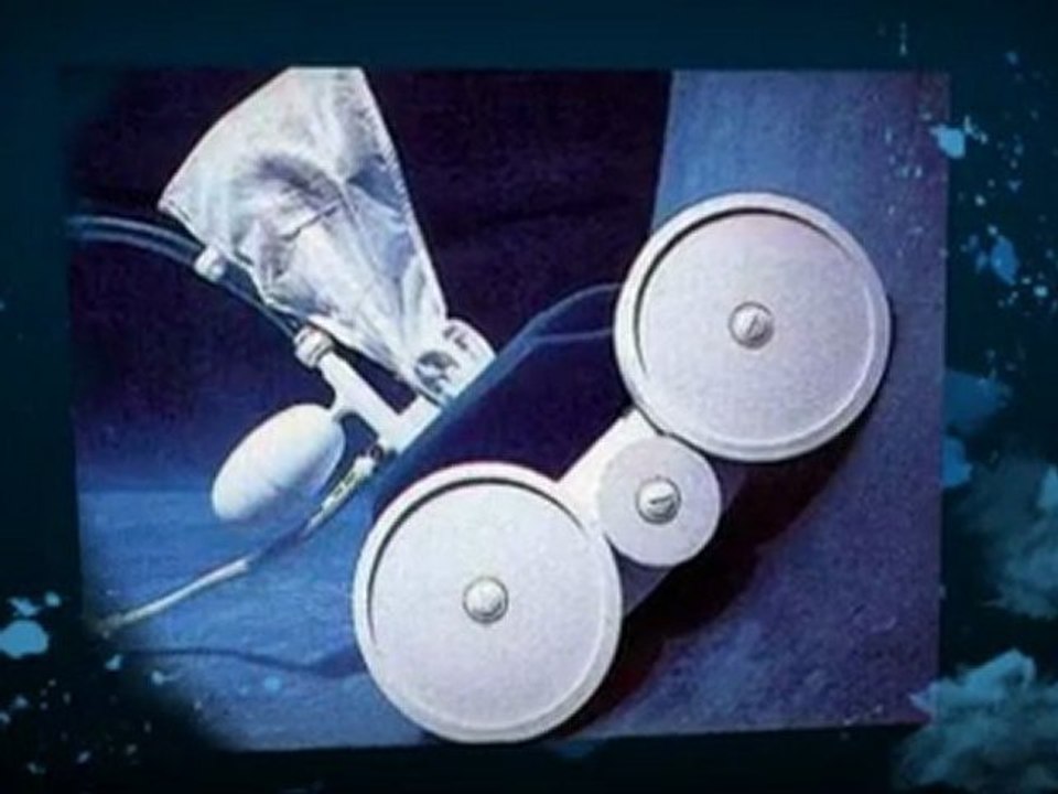 Polaris Pool Cleaners