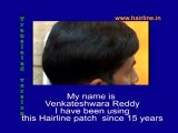 Best Price Hair Weaving and Bonding in Bangalore, Hair Weaving & Bonding Reviews